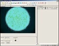 New Microbiology Imaging Software Offers Fast, Accurate Analysis of Colony Numbers and Zone Sizes
