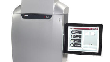 New Image Analysis Systems will Lead the Gel Image Analysis Market