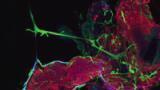 Fruit flys give insight into human metabolism