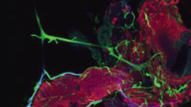 Fruit flys give insight into human metabolism