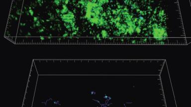 Cancer Research UK identifies novel role for CD169+ macrophages in activating Invariant Natural Killer T cells