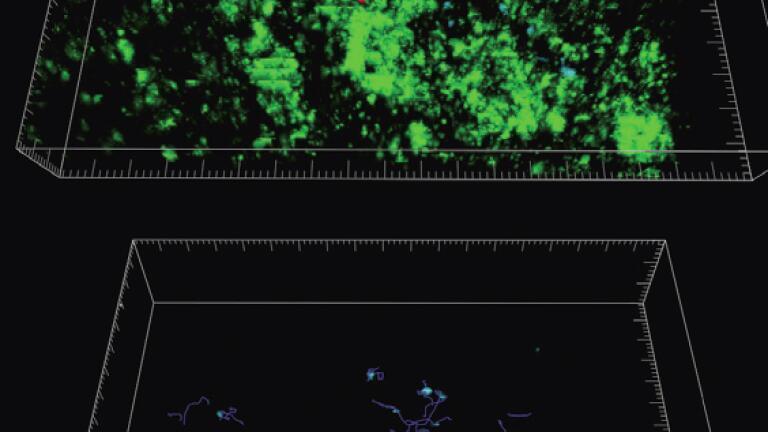 Cancer Research UK identifies novel role for CD169+ macrophages in activating Invariant Natural Killer T cells