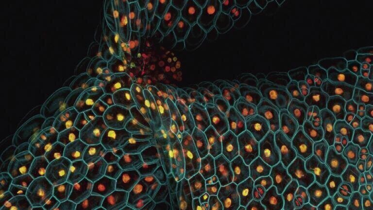 Cell division and gene expression in plants. Taken by: Fernan Federici,
University of Cambridge, and Lionel Dupuy, Scottish Crop Research
Institute/Wellcome Images