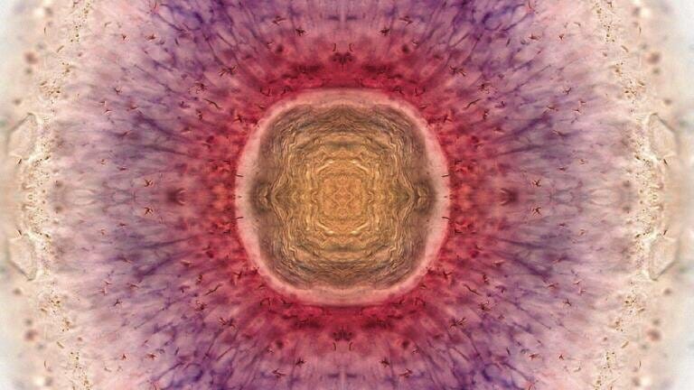Zebrafish retina. Taken by: Kara Cerveny, Steve Wilson\'s lab,
UCL/Wellcome Images