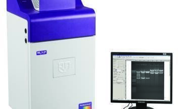 Chemiluminescent Imaging of Protein Blots
