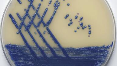 Newly Improved Chromogenic Medium for Rapid and Reliable MRSA Screening in Just 18 Hours