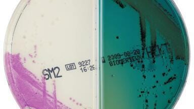 Extra Colour with ChromID Bi-Plates