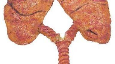 Never-smokers' lung tumours have 'greater genomic instability'