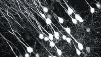 Multiphoton Imaging Simplified