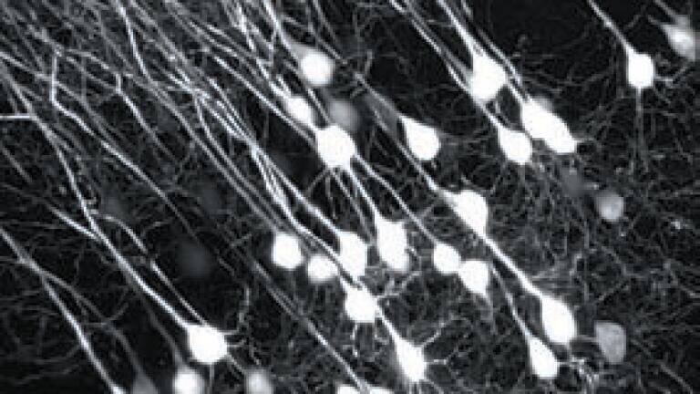 Multiphoton Imaging Simplified