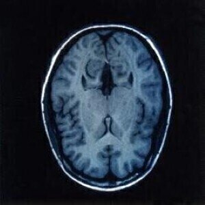 Mechanisms of traumatic brain injury identified