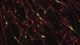 Researchers Grow Nerves for Parkinson’s Studies