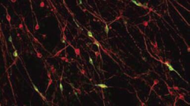 Researchers Grow Nerves for Parkinson’s Studies