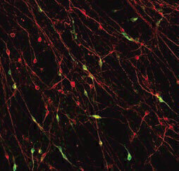 Researchers Grow Nerves for Parkinson’s Studies