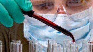 Scientists could find genetic link to schizophrenia