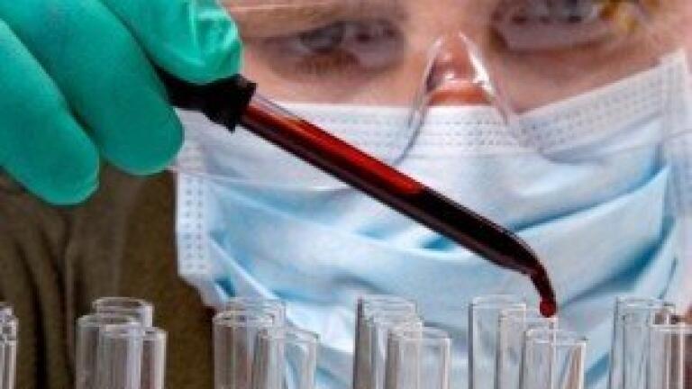 Scientists could find genetic link to schizophrenia