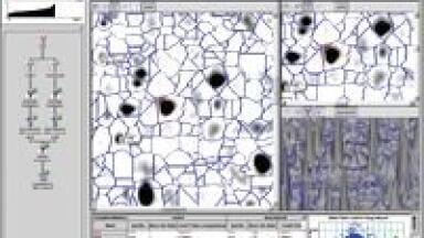 Specialist Institute Impressed by Gel Analysis Software
