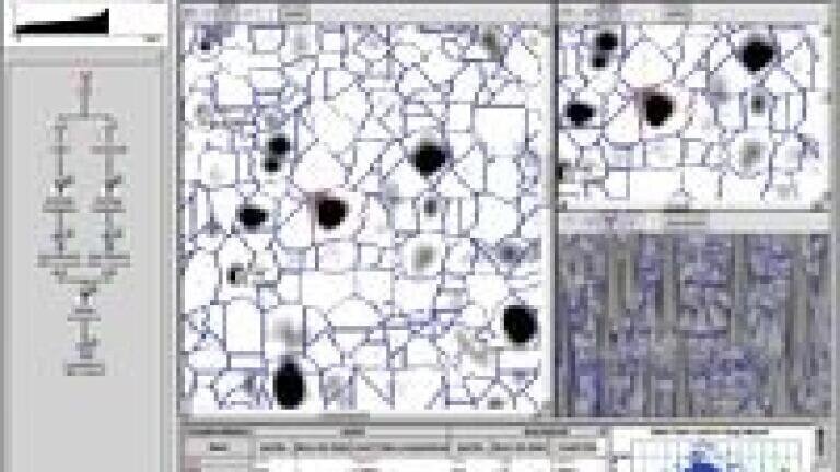 Specialist Institute Impressed by Gel Analysis Software