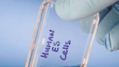 Breakthrough in Bioprocess Optimisation For Biologicals
