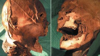 Identification of King Henry IV’s Head