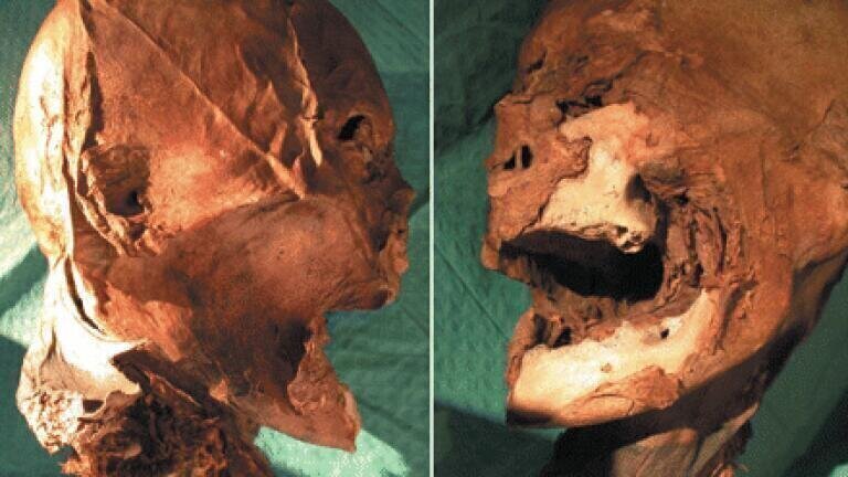 Identification of King Henry IV’s Head