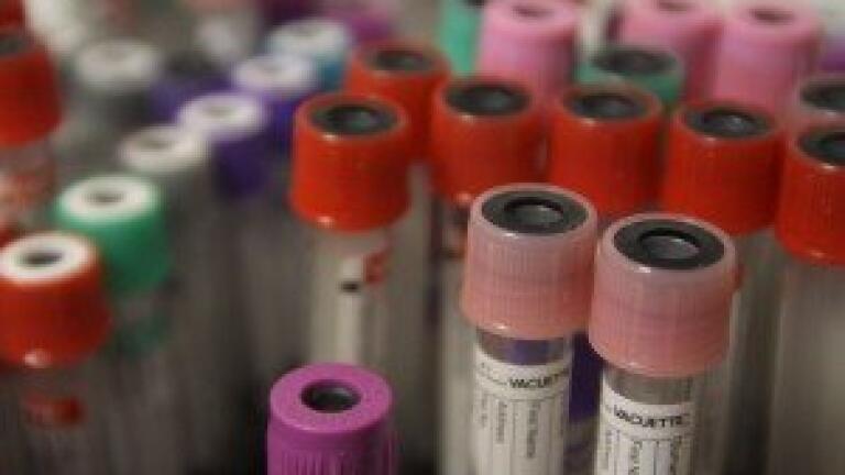Heart disease protein could be tested for