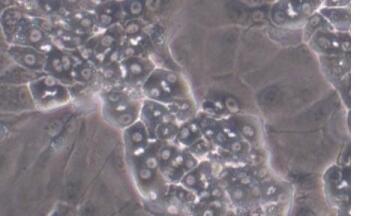 Merck Millipore to Offer HepaRG™ Terminally Differentiated Human Hepatic Cells