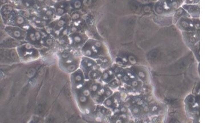 Merck Millipore to Offer HepaRG™ Terminally Differentiated Human Hepatic Cells