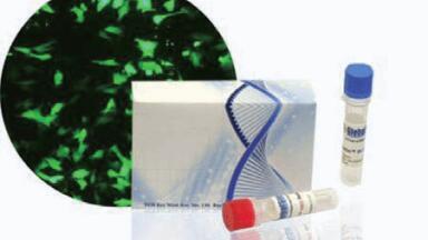 Optimised Gene Delivery Solution for Hard-to-Transfect Cells