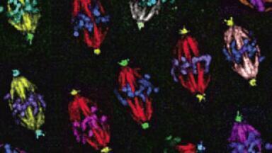 Advanced Imaging Systems to Follow Fluorescent RNA Movement in Living Cells