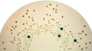 New Media for Cronobacter Sakazakii Isolation