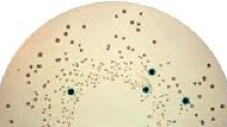 New Media for Cronobacter Sakazakii Isolation