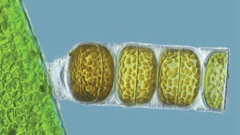 3rd Place
Frank Fox
Fachhochschule Trier
Trier, Rheinland-Pfalz, Germany
Melosira moniliformis, living specimen
(320X)
Differential Interference Contrast