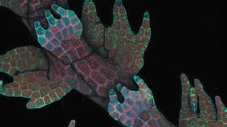 4th Place
Dr Robin Young
The University of British Columbia
Vancouver, British Columbia, Canada
Intrinsic fluorescence in Lepidozia reptans
(liverwort) (20X)
Live mount, Confocal microscopy