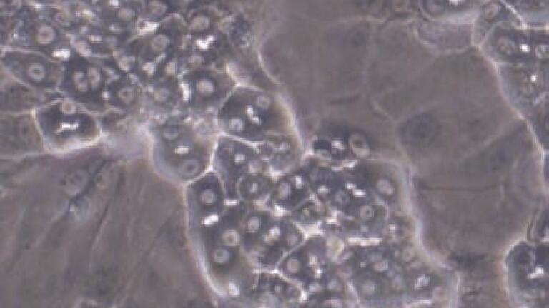 New Distributor of Cryopreserved Terminally Differentiated Human Hepatic Cells