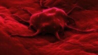 Molecular marker could predict tumor progression