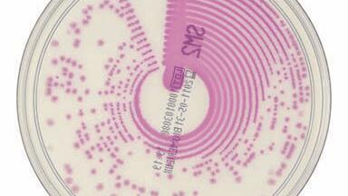 Chromogenic Media Detects S. typhi and S. paratyphi