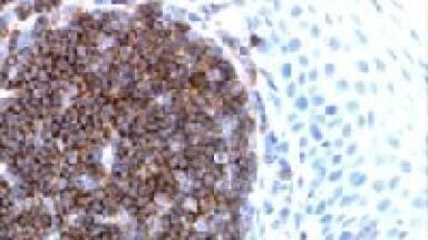 Unique Paraffin-reactive Anti-human Cd19 Monoclonal