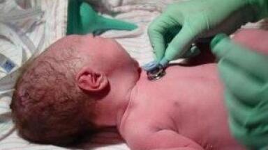 Low dose carbon monoxide therapy found to prevent miscarriage