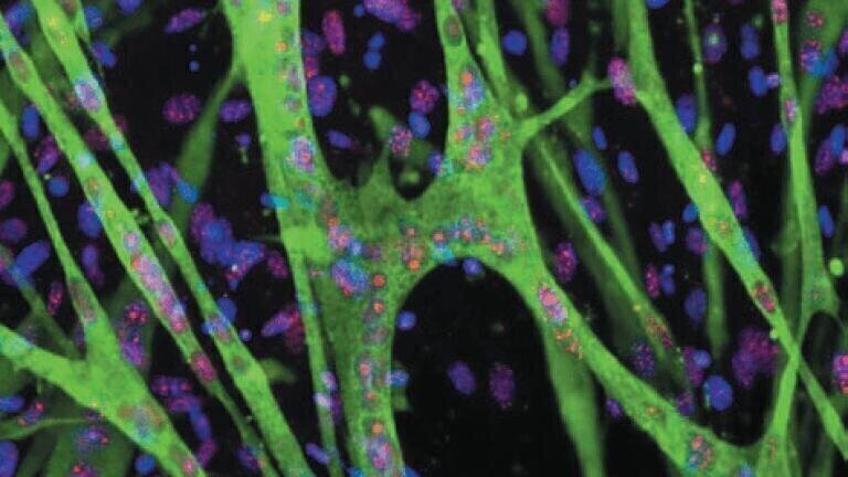 IN Cell Analyser Competition - Winners Announced