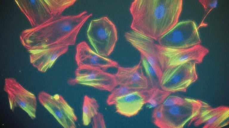 Pic B : Leslie Caron, GENEA, Australia
(Winner for Asia Pacific)
Vascular smooth muscle cells differentiated from human
embryonic stem cells stained for DNA (blue) and the smooth
muscle markers Smoothelin (red) and Caldesmon (green)