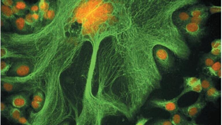 Pic C : Geoffrey Grandjean, MD Anderson Centre, USA (Winner for the Americas)
Human ovarian cancer cells stained for DNA (red) and microtubules (green).