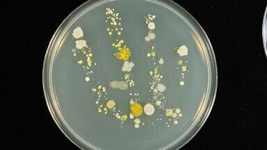 Magnificent microbes on show