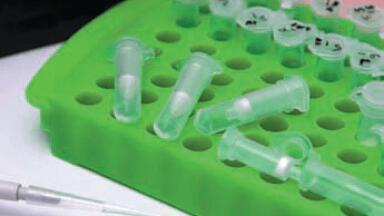 An Alternative Solid Phase Affinity Matrix for Chromatin Immunoprecipitation