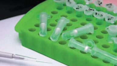 An Alternative Solid Phase Affinity Matrix for Chromatin Immunoprecipitation