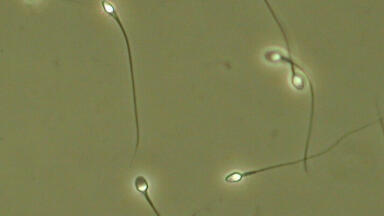 Temperature Controlled Warm Stages Chosen for Sperm Motility in Human Fertility Testing