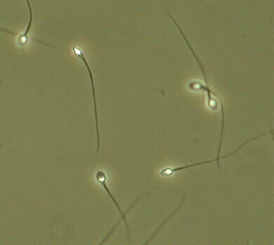 Temperature Controlled Warm Stages Chosen for Sperm Motility in Human Fertility Testing