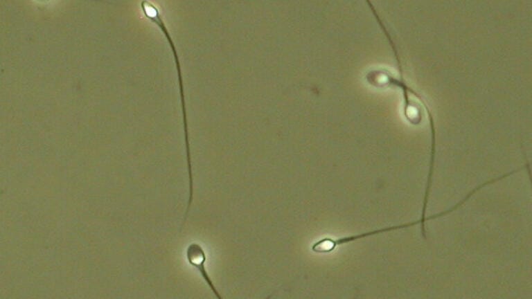 Temperature Controlled Warm Stages Chosen for Sperm Motility in Human Fertility Testing