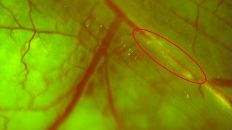 A multiplexed image of a skin flap, 2.5x.  The major vessel in the field corresponds to the epigastrica cranialis vein of a nude mouse.  Clusters of dual-colored HT-1080 cells can be visualized moving through the vasculature in the right-most aspect of the field. The field of view is 5.8 x 5.8mm.