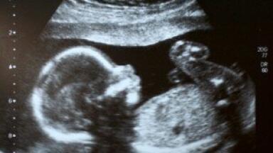 Non-invasive approach to obtaining fetal genome developed in lab